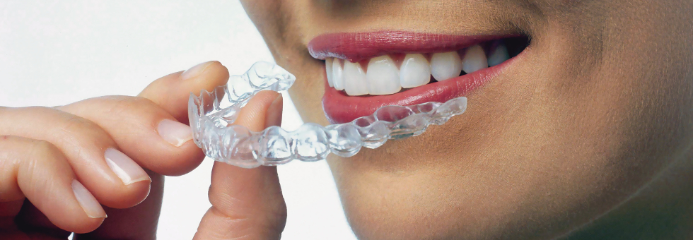 Invisalign