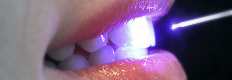Laser a diodi medicale