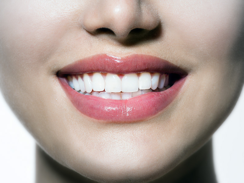 Sbiancamento dei denti con laser a diodi da Dental-Luc a Milano