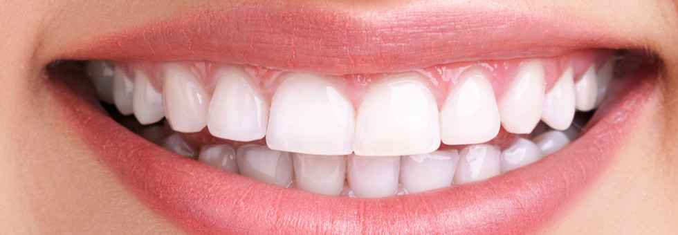 Sbiancamento dei denti