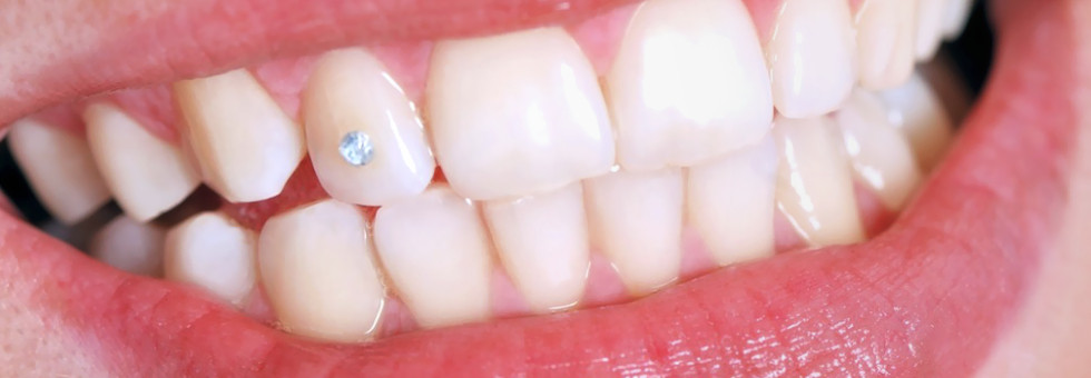 Brillantino sul dente